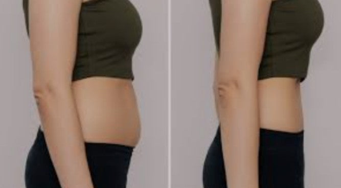 Agende Tratamento Gordura Localizada com Heccus + Carbox | Estetica CM