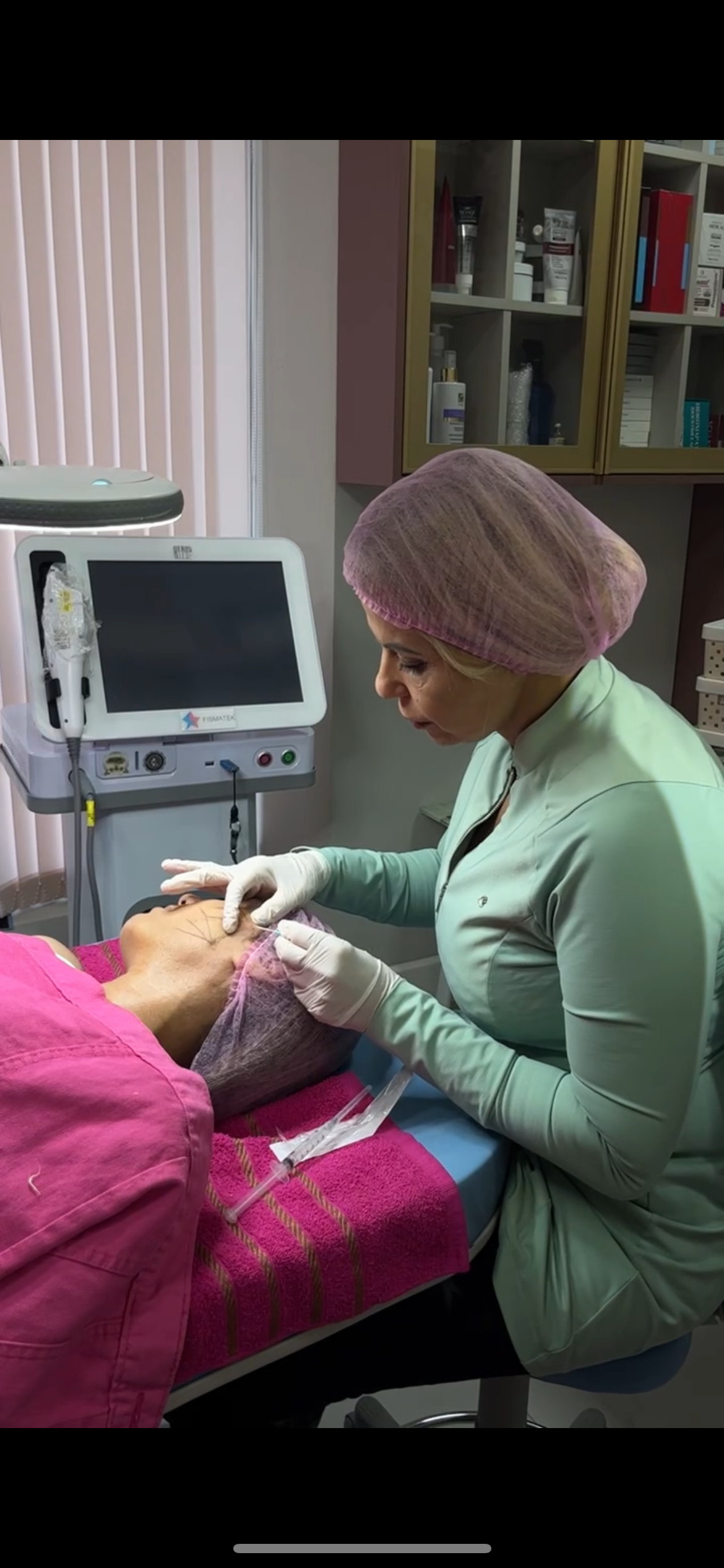 Fios de Sustentação Tração 8 Fios| Estetica CM