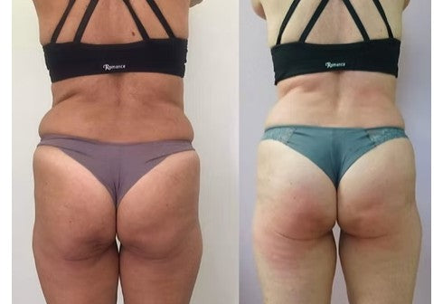 Agende Avaliação gratuita para Ultrassom Microfocado HERUS COSTA | Estetica CM