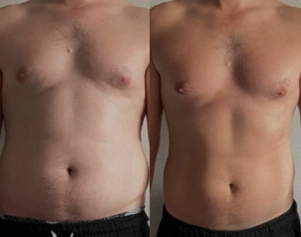 Agende Criolipólise na Estetica Clau Mazzucatto Bethaville Barueri