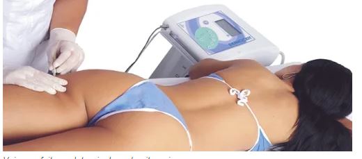 Agende Avaliação para Carboxterapia Coxa | Estetica CM