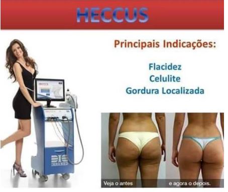 Agende Avaliação para Drenagem Heccus Turbo | Estetica CM