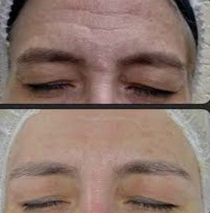 Agende avaliação para Jato de Plasma Testa | Estetica CM