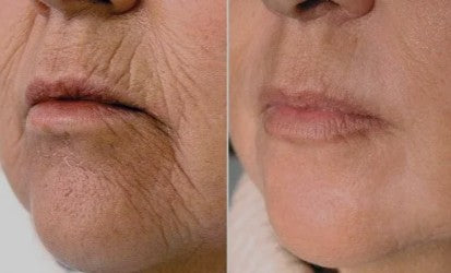 Agenda avaliação para Jato de Plasma Boca | Estetica CM