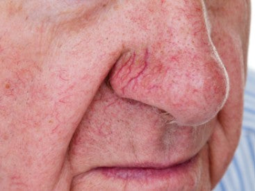 Agende avaliação para Lyra Vazinhos Nariz | Estetica CM