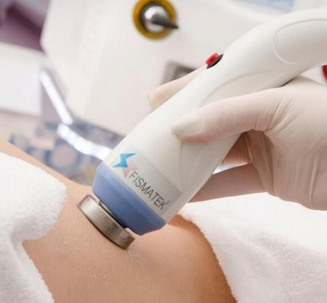 Agende Avaliação para Criofrequência | Estetica CM