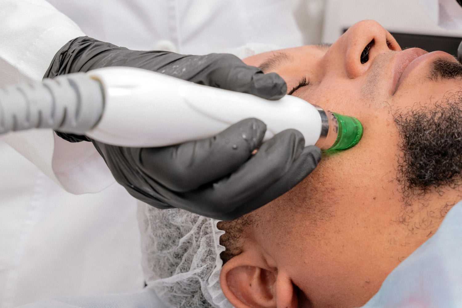 Jato de Plasma | Estetica CM Bethaville Barueri