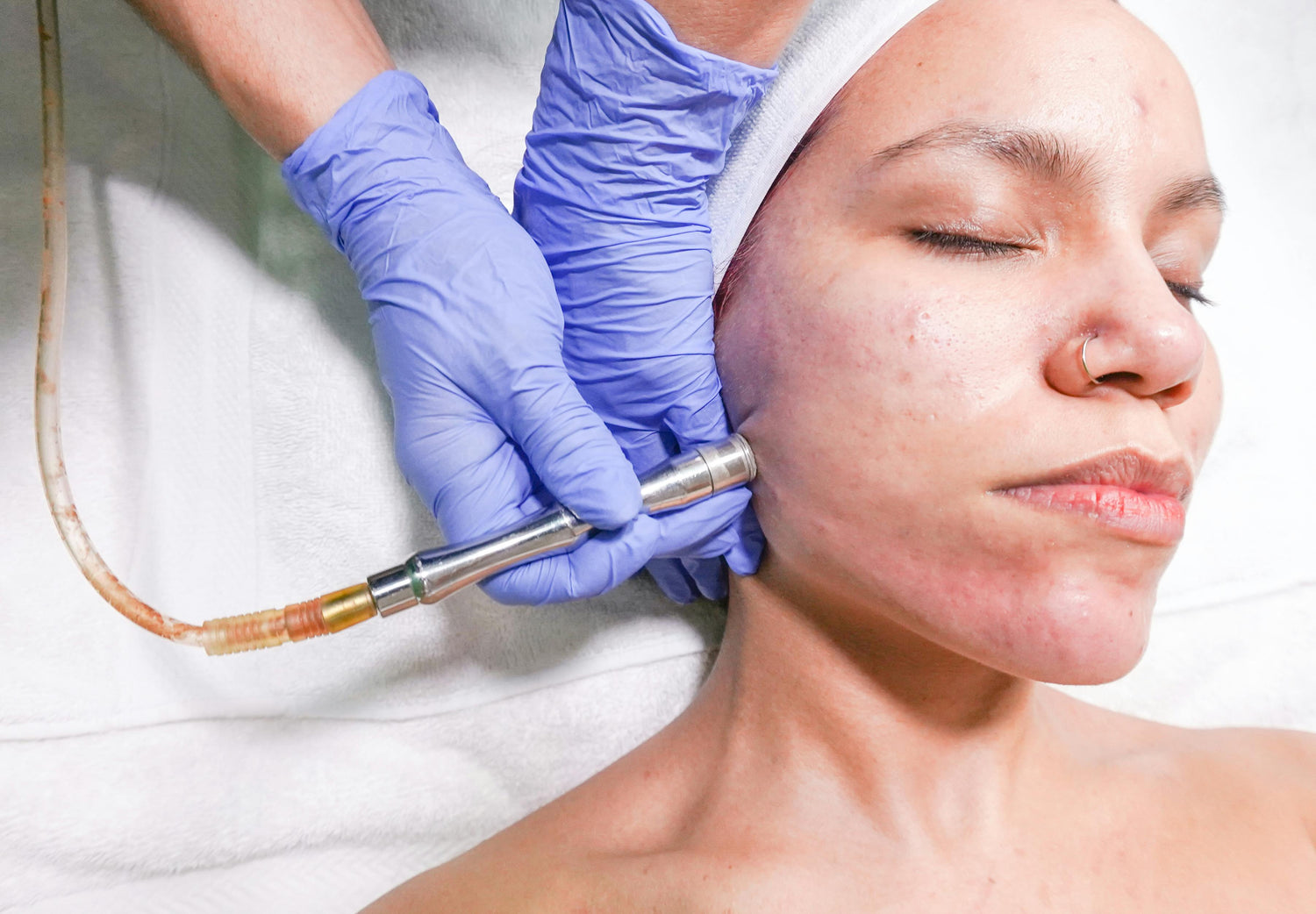 Ozonoterapia | Estetica CM Bethaville Barueri