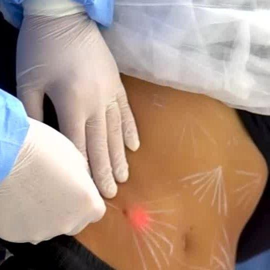 Agende Endolaser Estetica CM Barueri Bethaville