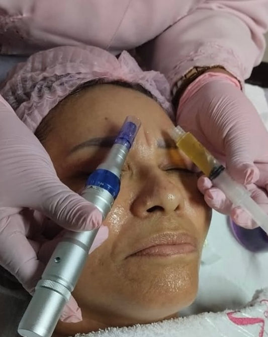 Agende avaliação para Microagulhamento + PRP | Estetica CM