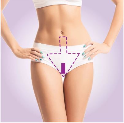 Agende Avaliaçao para Depilação Intima de Virilha  | Estetica CM