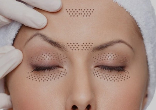 Agende avaliação para Jato de Plasma Testa | Estetica CM