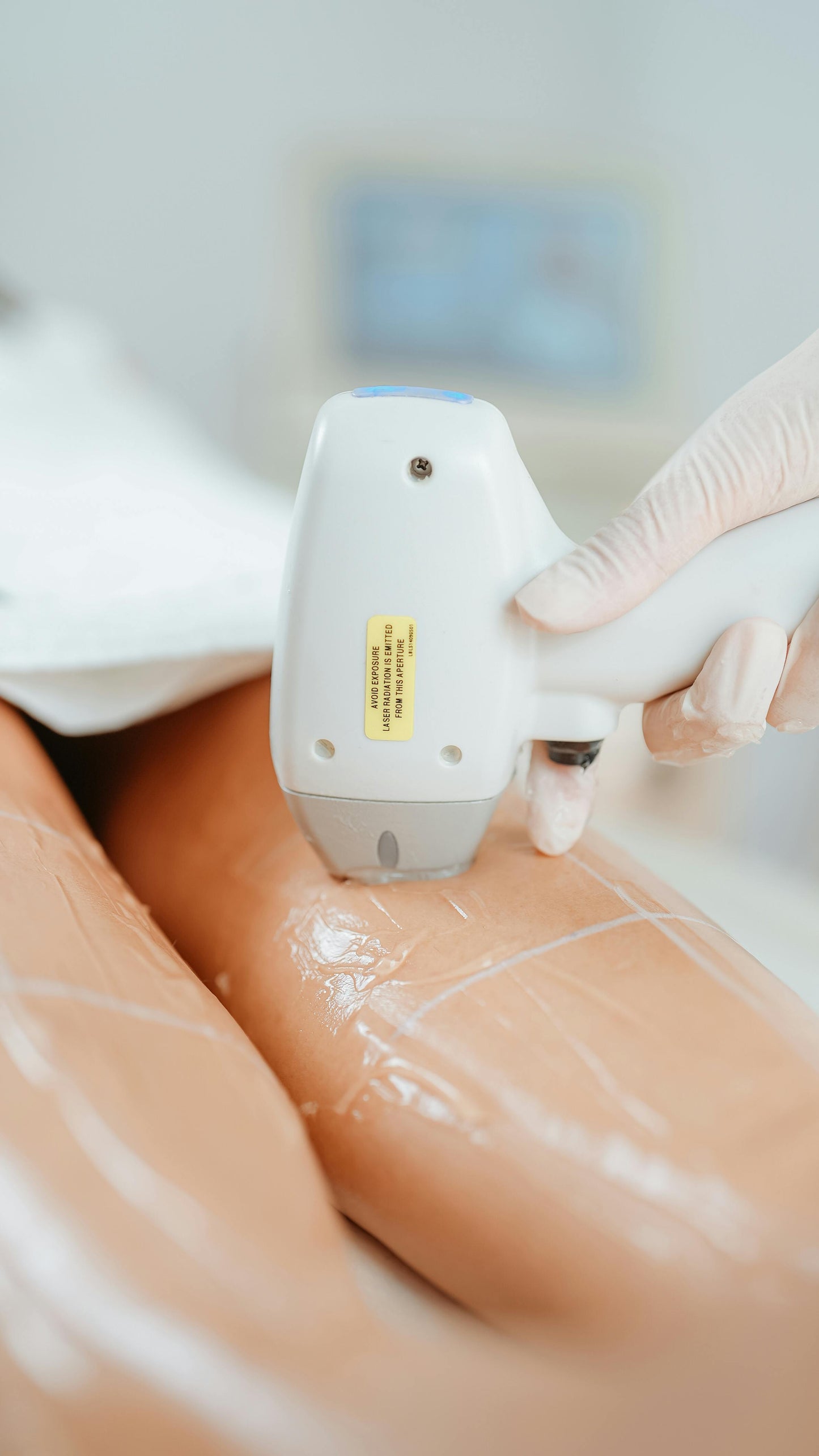 Agende Avaliação para Heccus + Carbox para Celulite  | Estetica CM