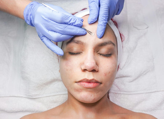 Agende Avaliação Peeling Vulcan Ice com Home Care | Estetica CM